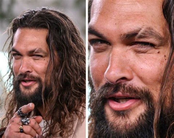 9 Famous People and the Story Behind Their Not-So-famous Scars
