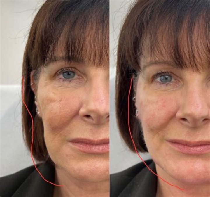 Arisce Wanzer had her jawline re-sculpted years before Ex on the Beach Fri 8 April 2022 11:01