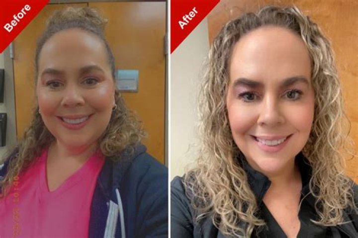 Before & After Pics Hollywood Life