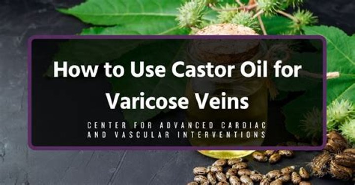 Castor Oil For Spider Veins: Unveiling Promising Discoveries