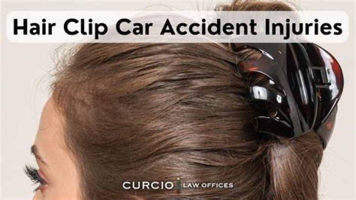 Claw Clip Car Accidents And Uncovering The Path To Prevention