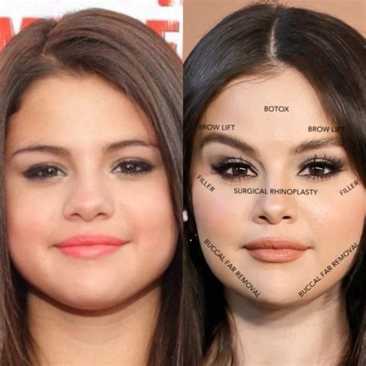 Did Nelly Furtado Get Plastic Surgery: Before & After! ·
