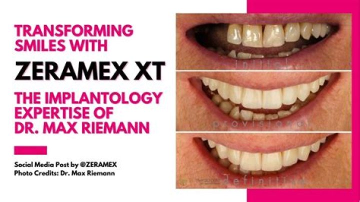 Dr. Mireya Mayor Lips Surgery: Transforming Smiles with Expertise