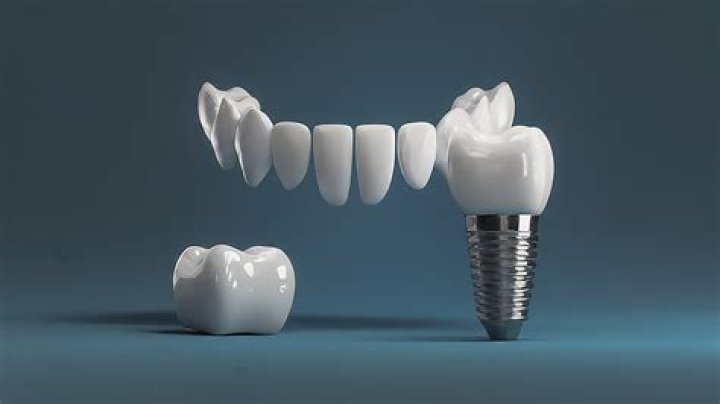 GleamVibe | Dental Digest
