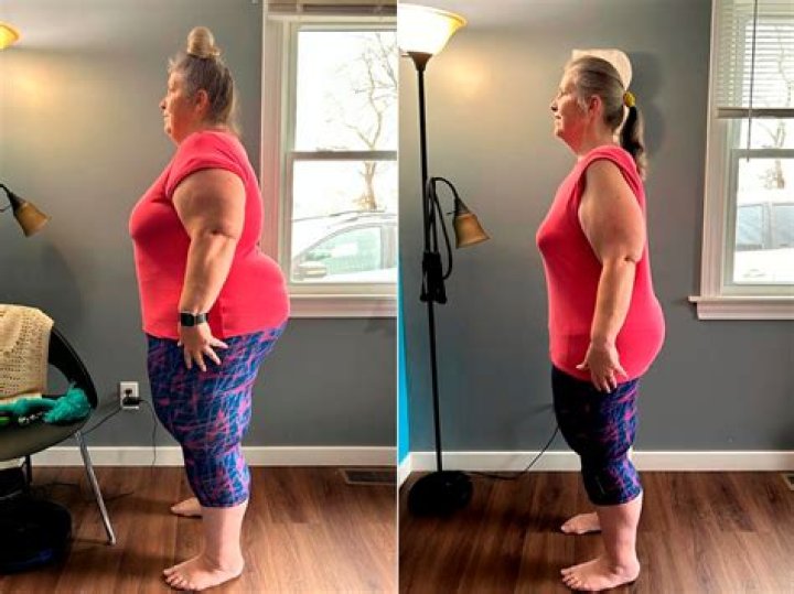 Karol G's Weight Loss Journey