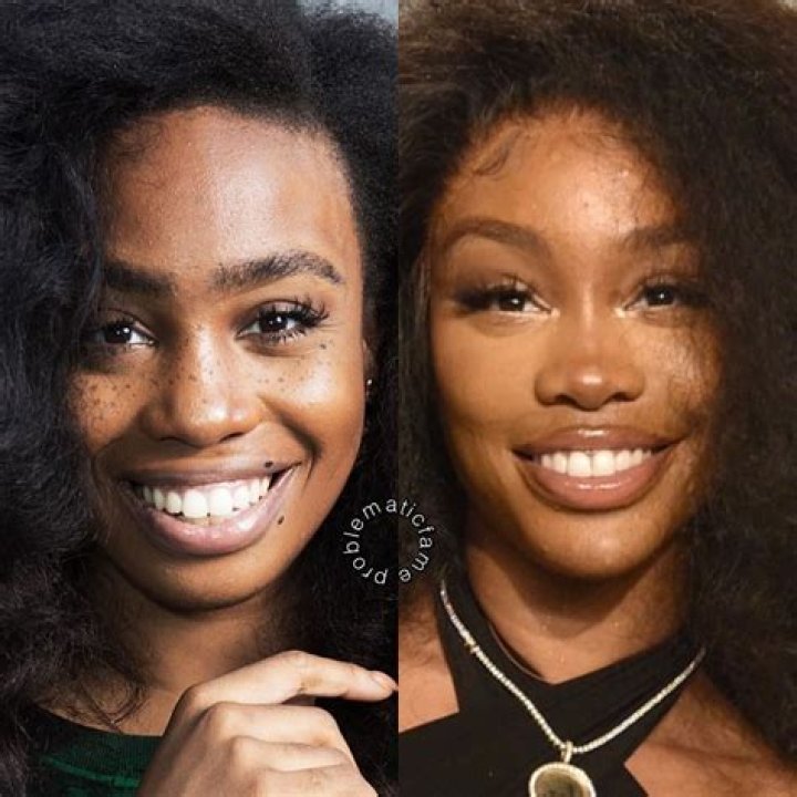 Unveiling Black Chyna's Journey: Before And After Surgery