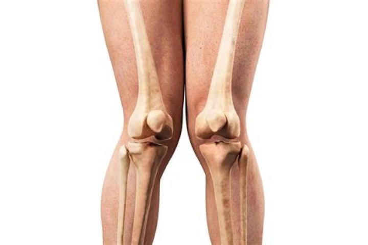 Unveiling The Secrets Of Knock Knees Celebrities: Discoveries And Insights